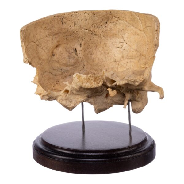 Real Human Partial Skull on Stand – 300 g