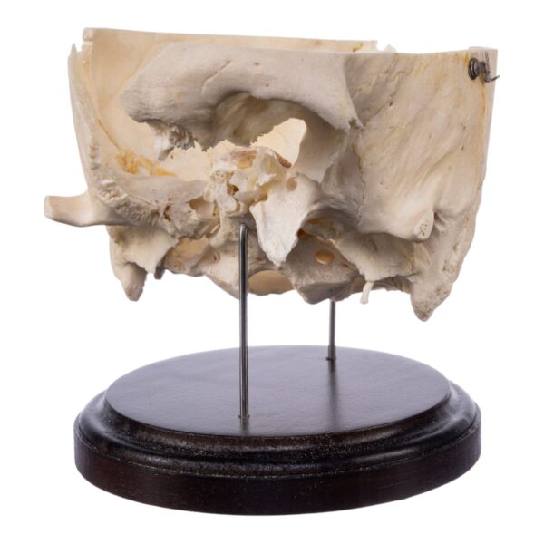 Real Human Partial Skull on Stand – 322 g