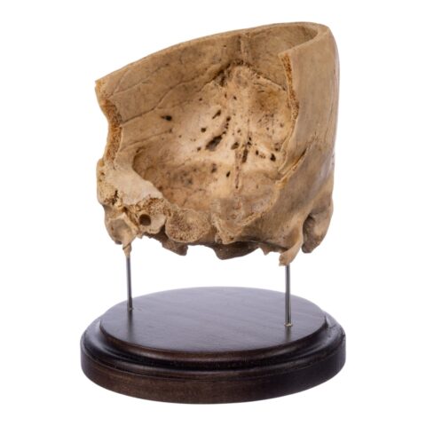 Real Human Partial Skull on Stand - 290 g