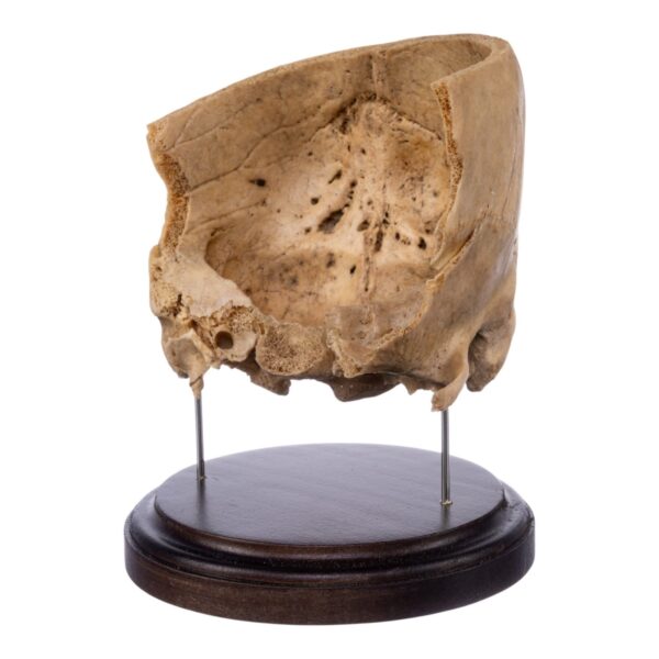 Real Human Partial Skull on Stand – 290 g
