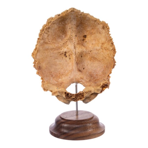 Real Human Partial Skull on Stand – 108 g