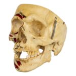 Real Human Skull – Partial, Painted