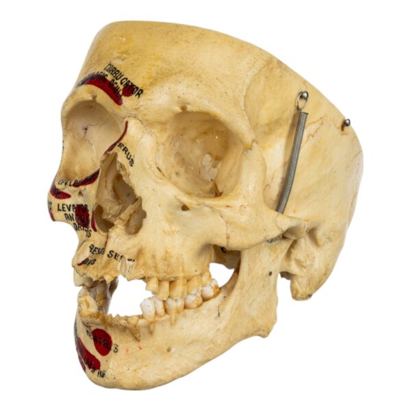 Real Human Skull – Partial, Painted