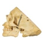 Real Human Skull – Partial, Painted