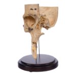 Real Human Partial Skull – Dissected