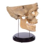 Real Human Partial Skull – Dissected