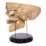Real Human Partial Skull – Dissected
