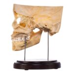Real Human Partial Skull on Stand – 244 g