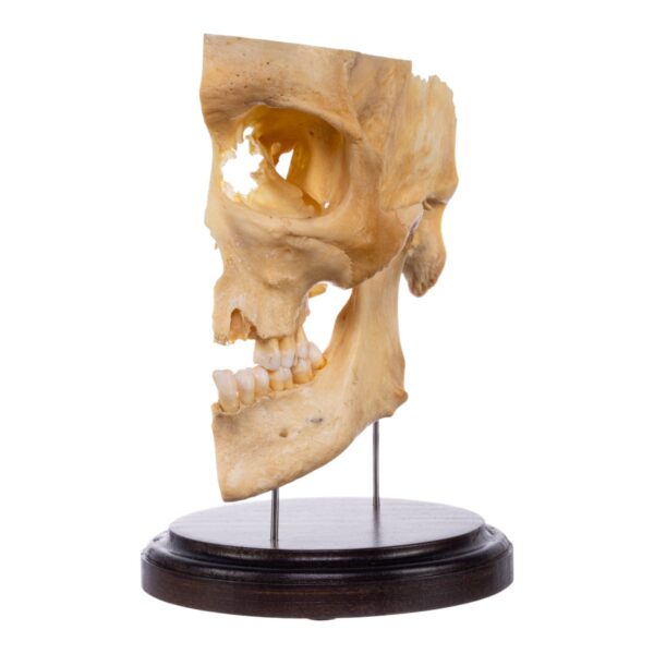 Real Human Partial Skull on Stand – 250 g