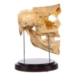 Real Human Partial Skull on Stand – 250 g