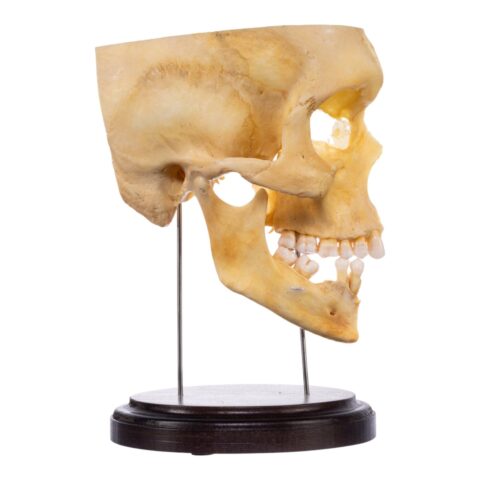Real Human Partial Skull on Stand - 244 g