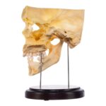 Real Human Partial Skull on Stand – 244 g