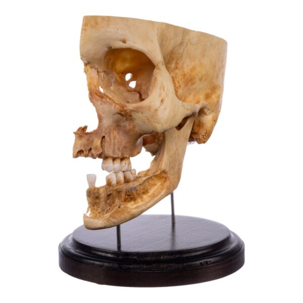 Real Human Partial Skull on Stand – 298 g