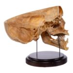 Real Human Partial Skull on Stand – 298 g