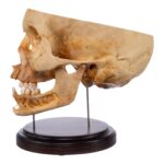 Real Human Partial Skull on Stand – 298 g