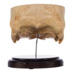 Real Human Partial Skull on Stand – 238 g