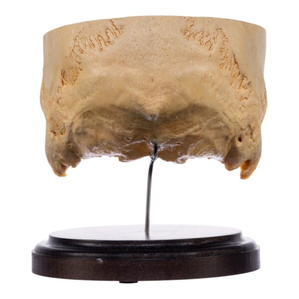 Real Human Partial Skull on Stand – 238 g