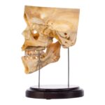 Real Human Partial Skull
