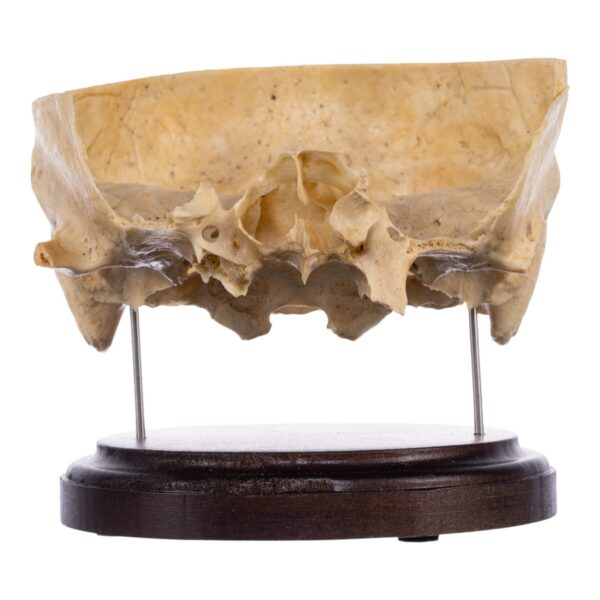Real Human Partial Skull on Stand – 286 g