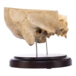 Real Human Partial Skull on Stand – 286 g