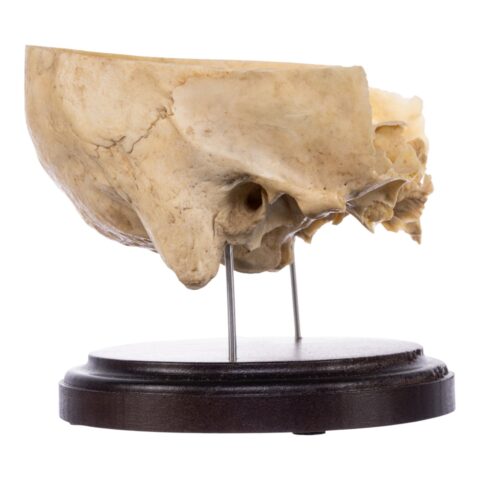 Real Human Partial Skull on Stand - 286 g