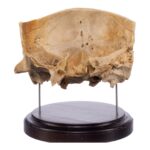 Real Human Partial Skull on Stand – 274 g