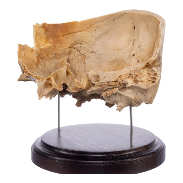 Real Human Partial Skull on Stand – 274 g