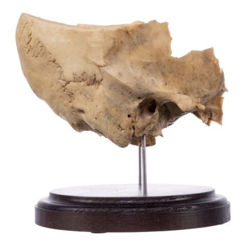 Real Human Partial Skull on Stand - 274 g