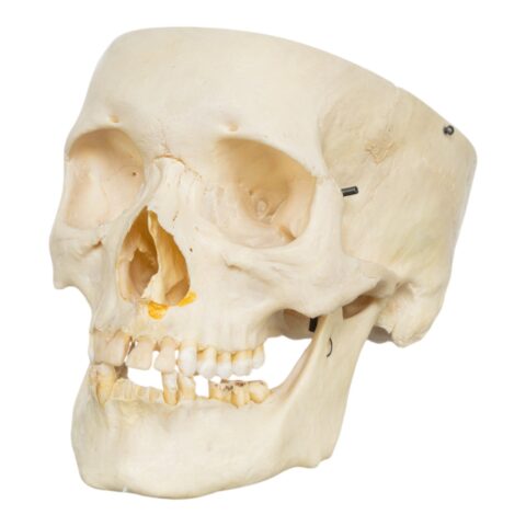 Real Human Skull - Partial