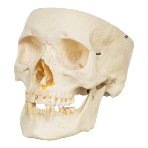 Real Human Skull – Partial