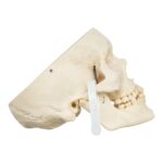 Real Human Skull – Partial