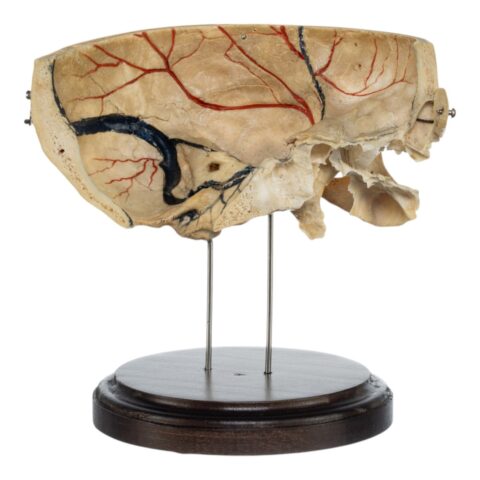 Real Human Partial Skull on Stand - 272 g