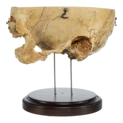 Real Human Partial Skull on Stand - 272 g
