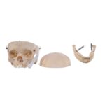 Real Human Child Skull