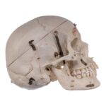 Real Human Skull – Dissected