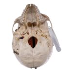 Real Human Skull – Dissected