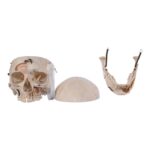 Real Human Skull – Dissected