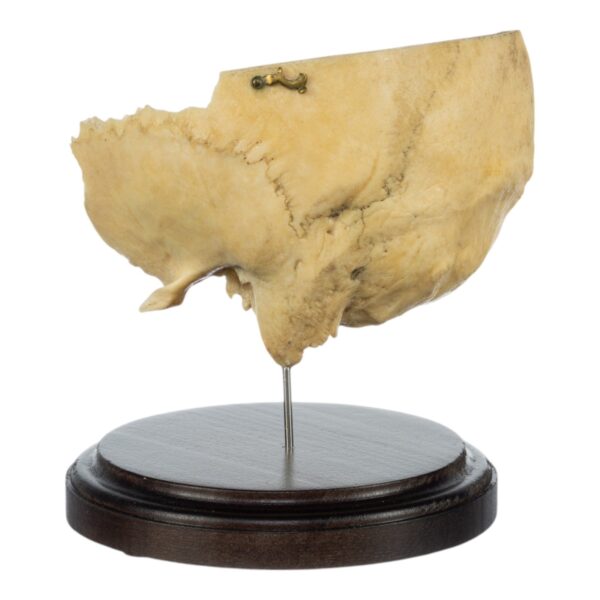 Real Human Partial Skull on Stand – 220 g