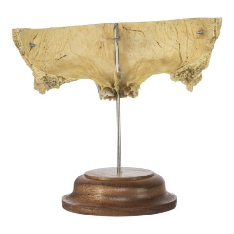 Real Human Partial Frontal Bone on Stand - 66 g