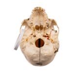 Real Human Skull – Dissected – With Stand
