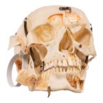 Real Human Skull – Dissected – With Stand