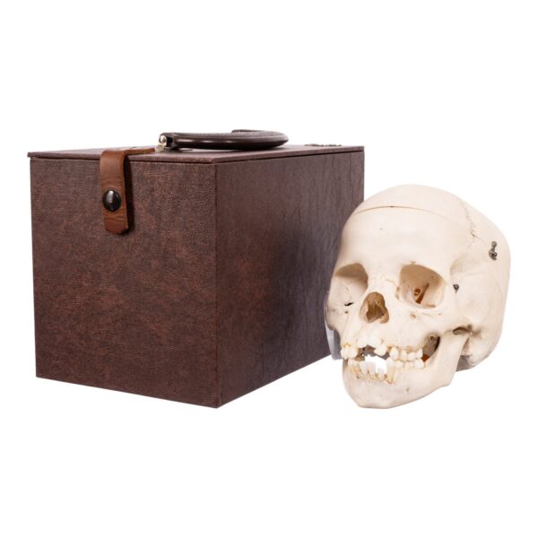 Real Child Human Skull With Case