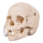 Real Child Human Skull With Case