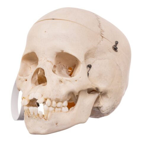 Real Child Human Skull With Case