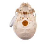 Real Child Human Skull With Case