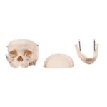 Real Child Human Skull With Case