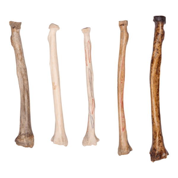 Real Human Radius – Antique