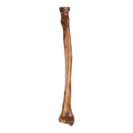Real Human Radius – Antique