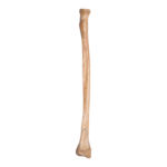 Real Human Radius – Antique
