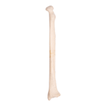 Real Human Radius – Antique
